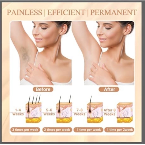 Brand New IPL Permanent Laser Hair Removal Device Painless 999,900 Flashes - Picture 9 of 14